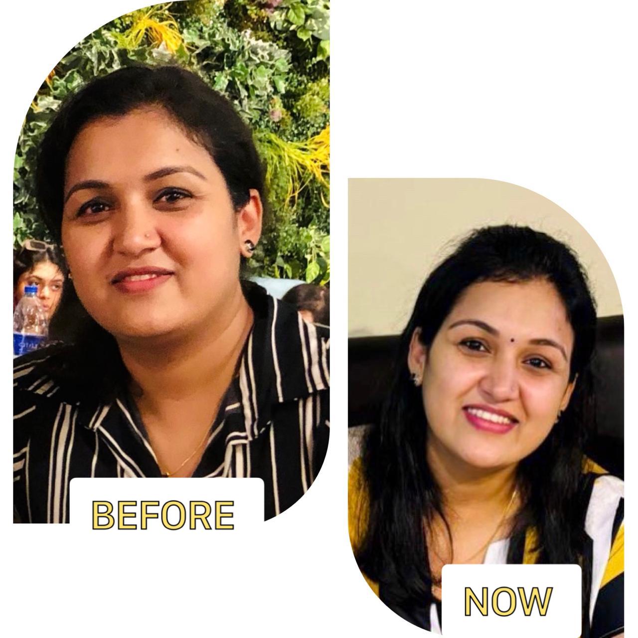 Member transformation